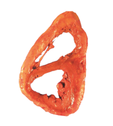 Lungs specimen captured with Model 702 system